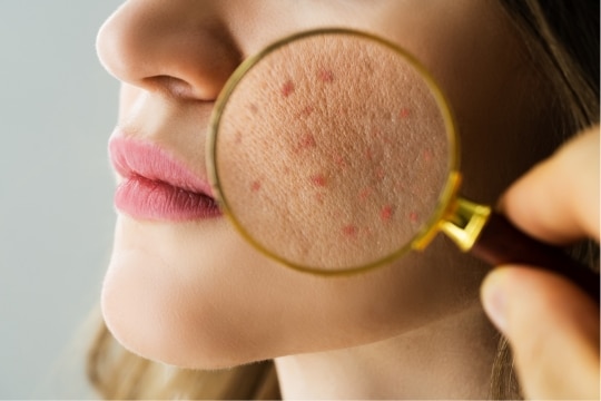 Dermatología