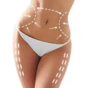 Lipo 360