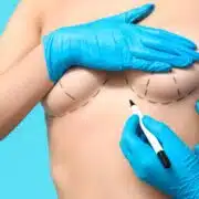 Mastopexia / Mamoplastia